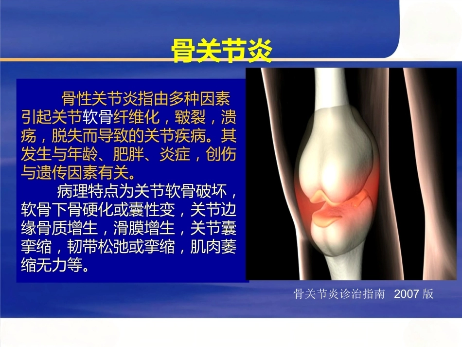 膝关节骨性关节炎的分 级治疗_第3页