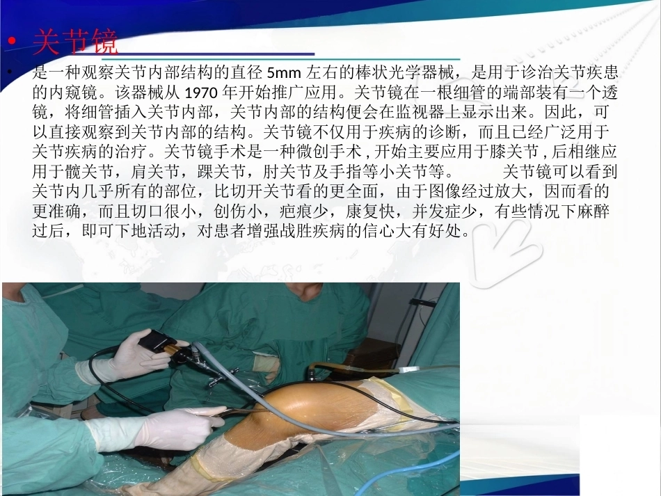 膝关节解 剖及关节镜手术_第9页