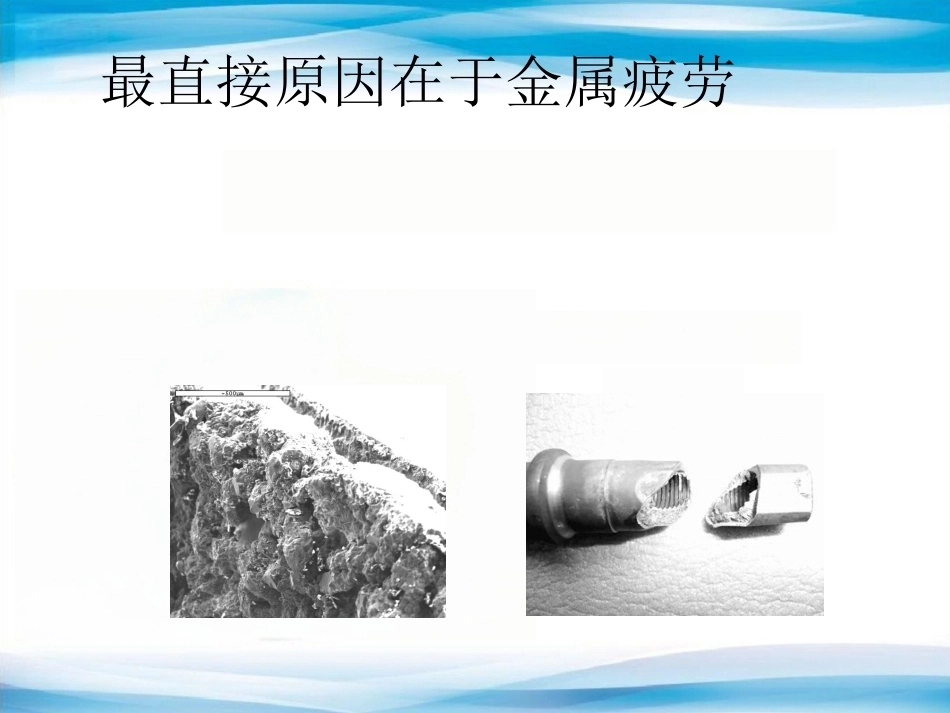 内植物断裂原因分析_第2页