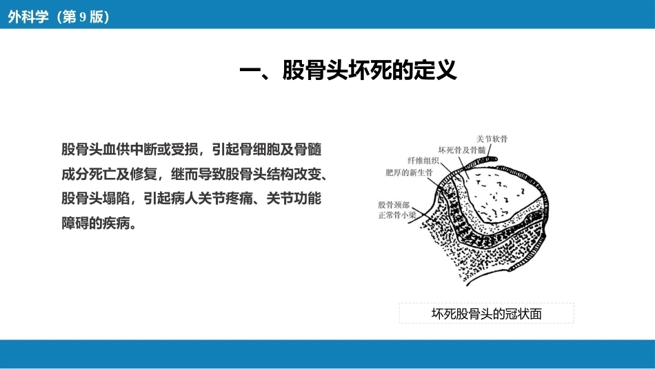 股骨 头坏死_第4页