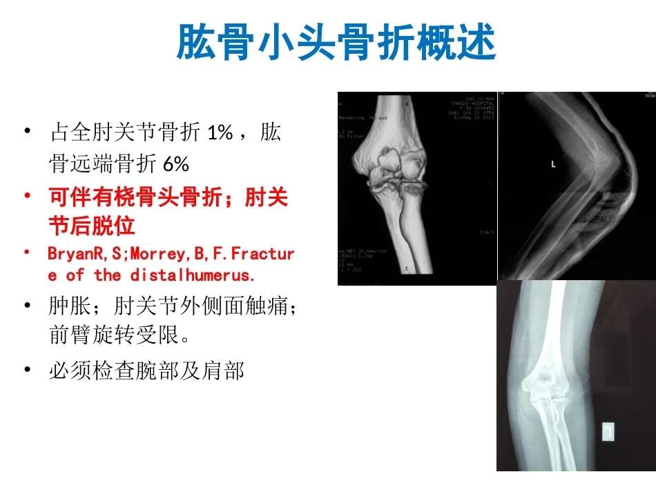 肱骨小头骨折的手术技巧_第3页
