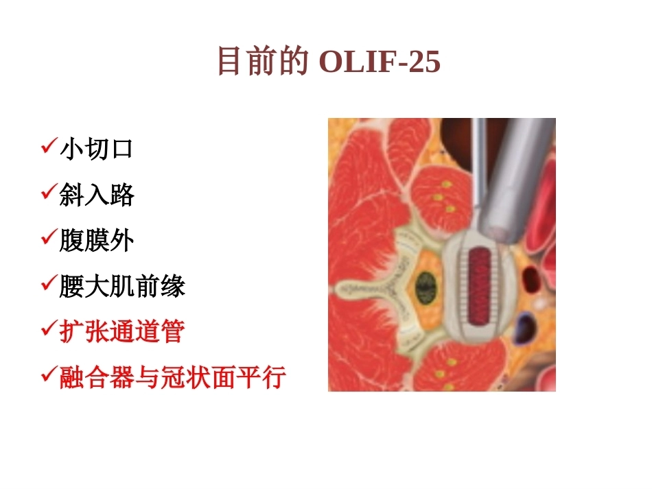 OLIF入路和相关解 剖_第12页