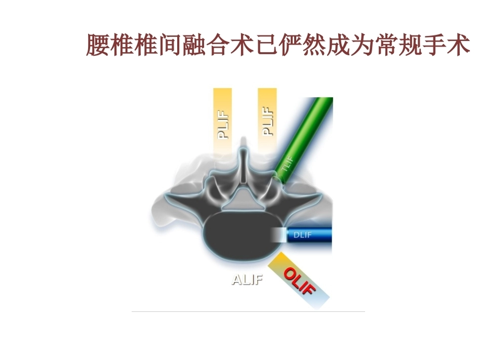 OLIF入路和相关解 剖_第2页