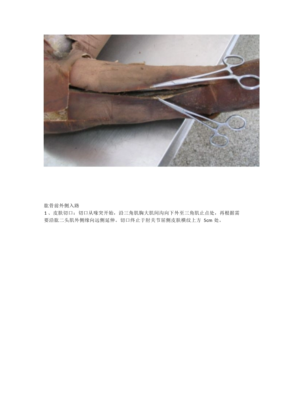 骨科解剖及手 术切口入路_第11页