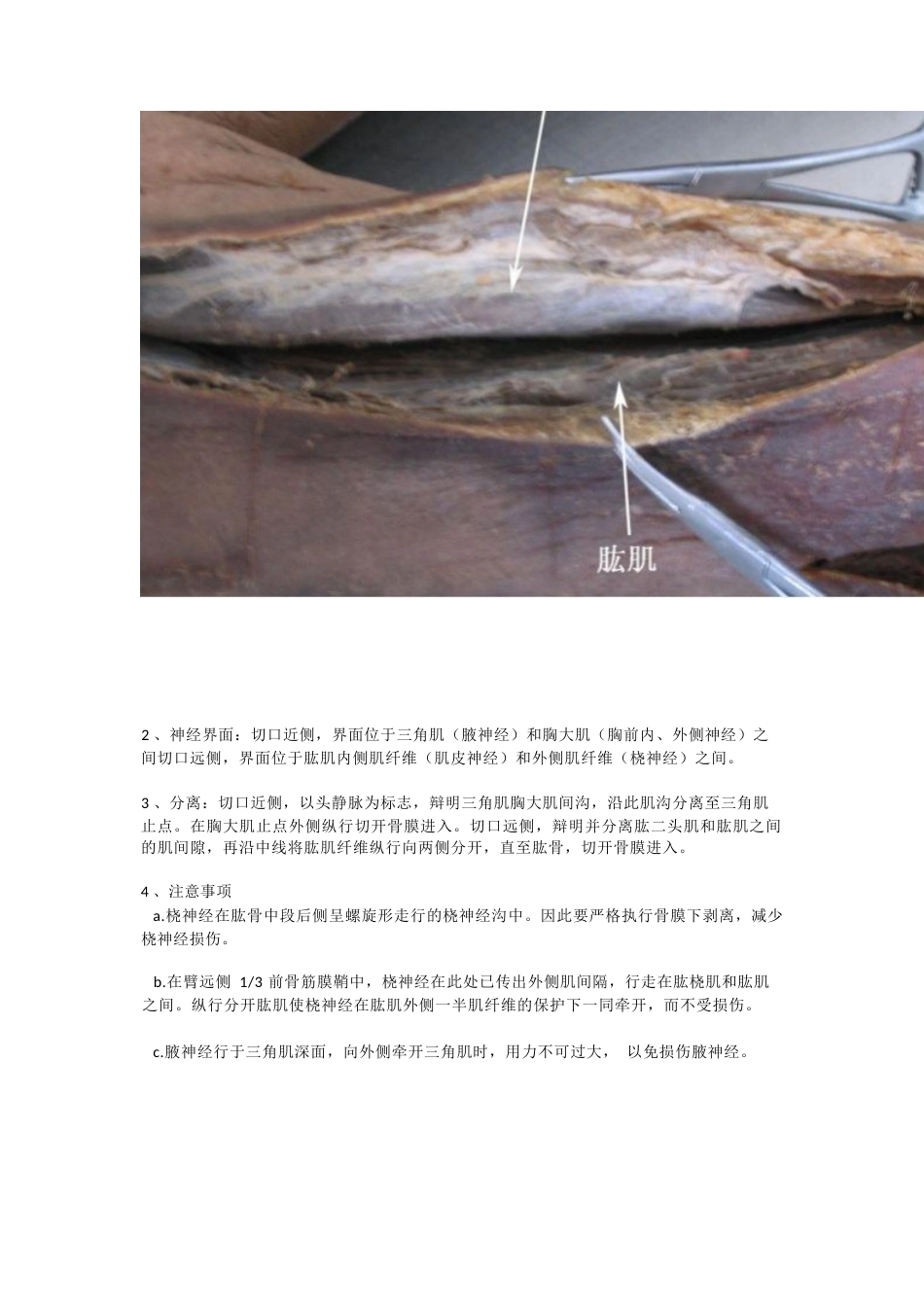 骨科解剖及手 术切口入路_第12页