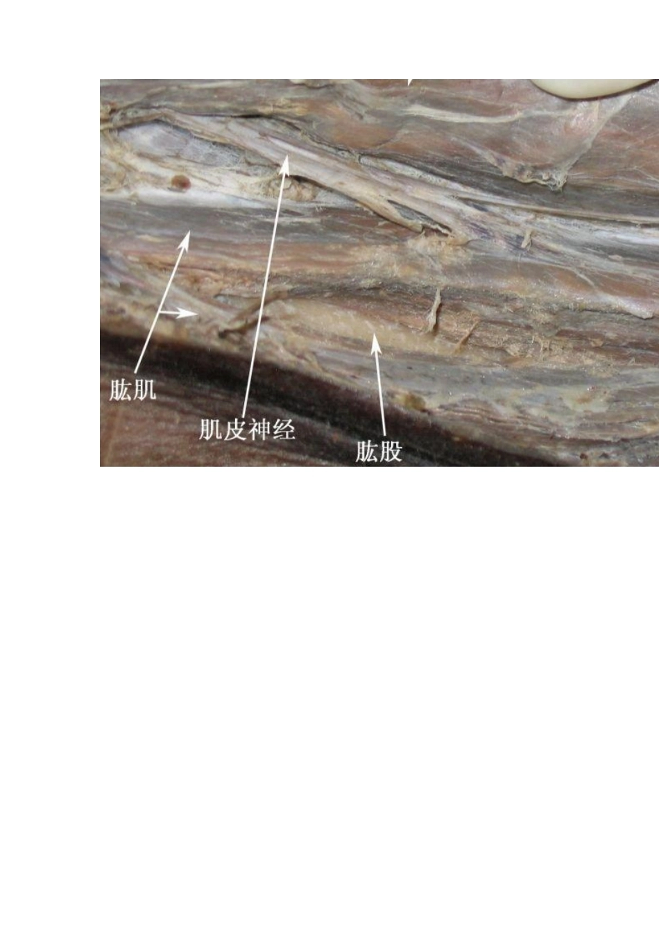 骨科解剖及手 术切口入路_第13页