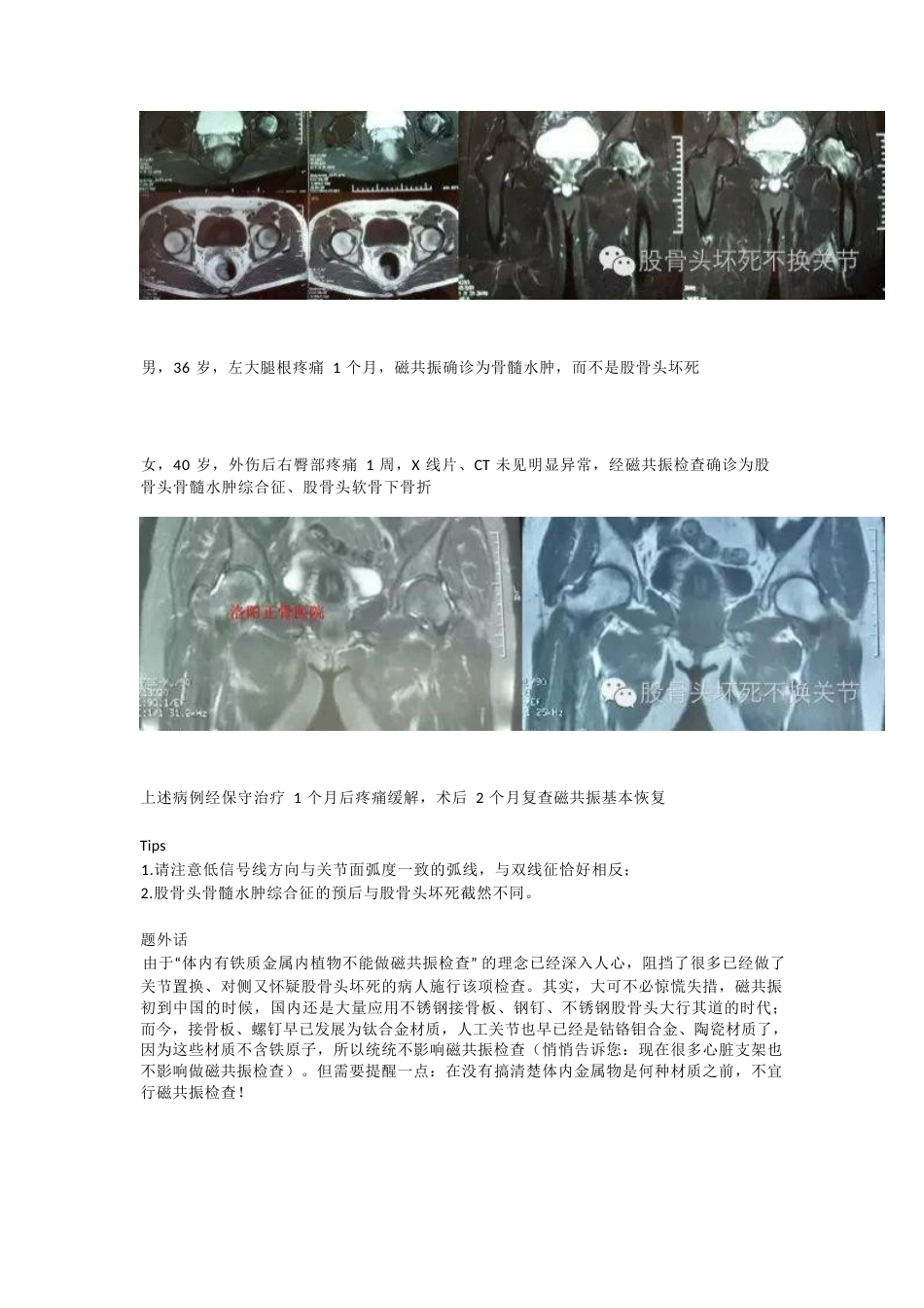 股骨头坏死应该怎样 做检查_第7页