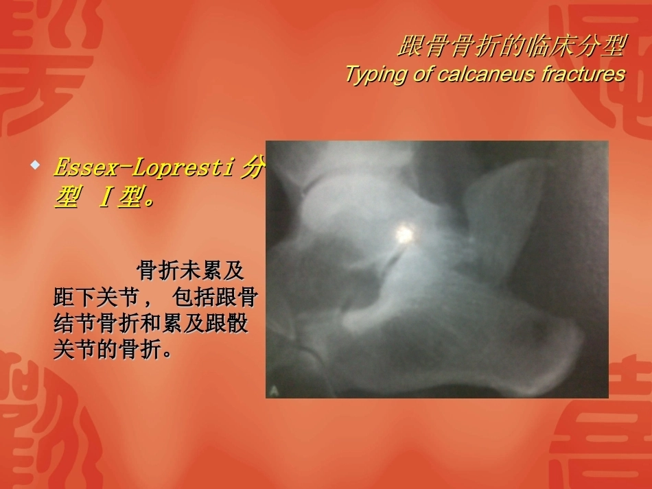 跟骨骨折的分型与治疗_第11页