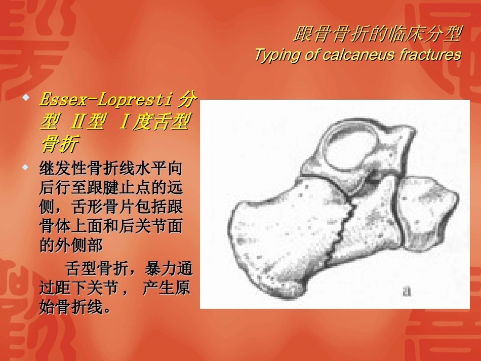 跟骨骨折的分型与治疗_第13页