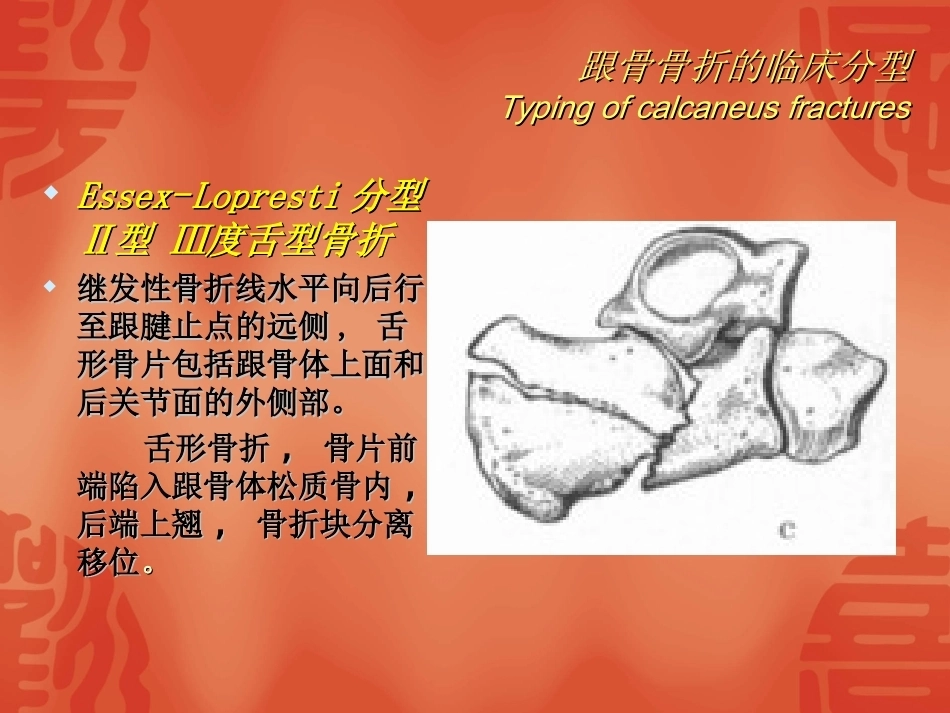 跟骨骨折的分型与治疗_第15页