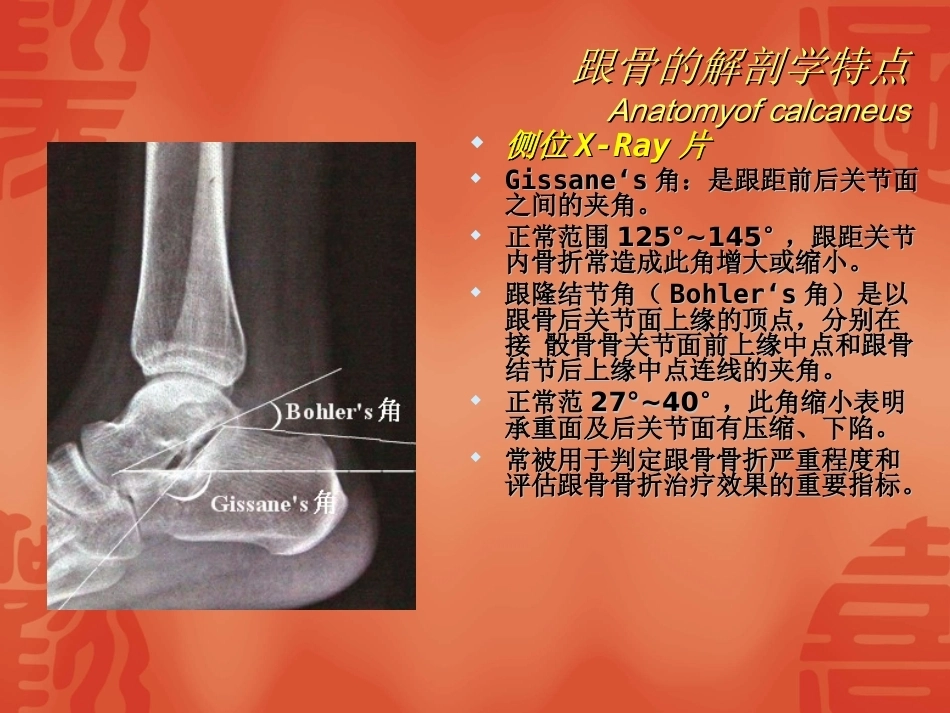 跟骨骨折的分型与治疗_第3页