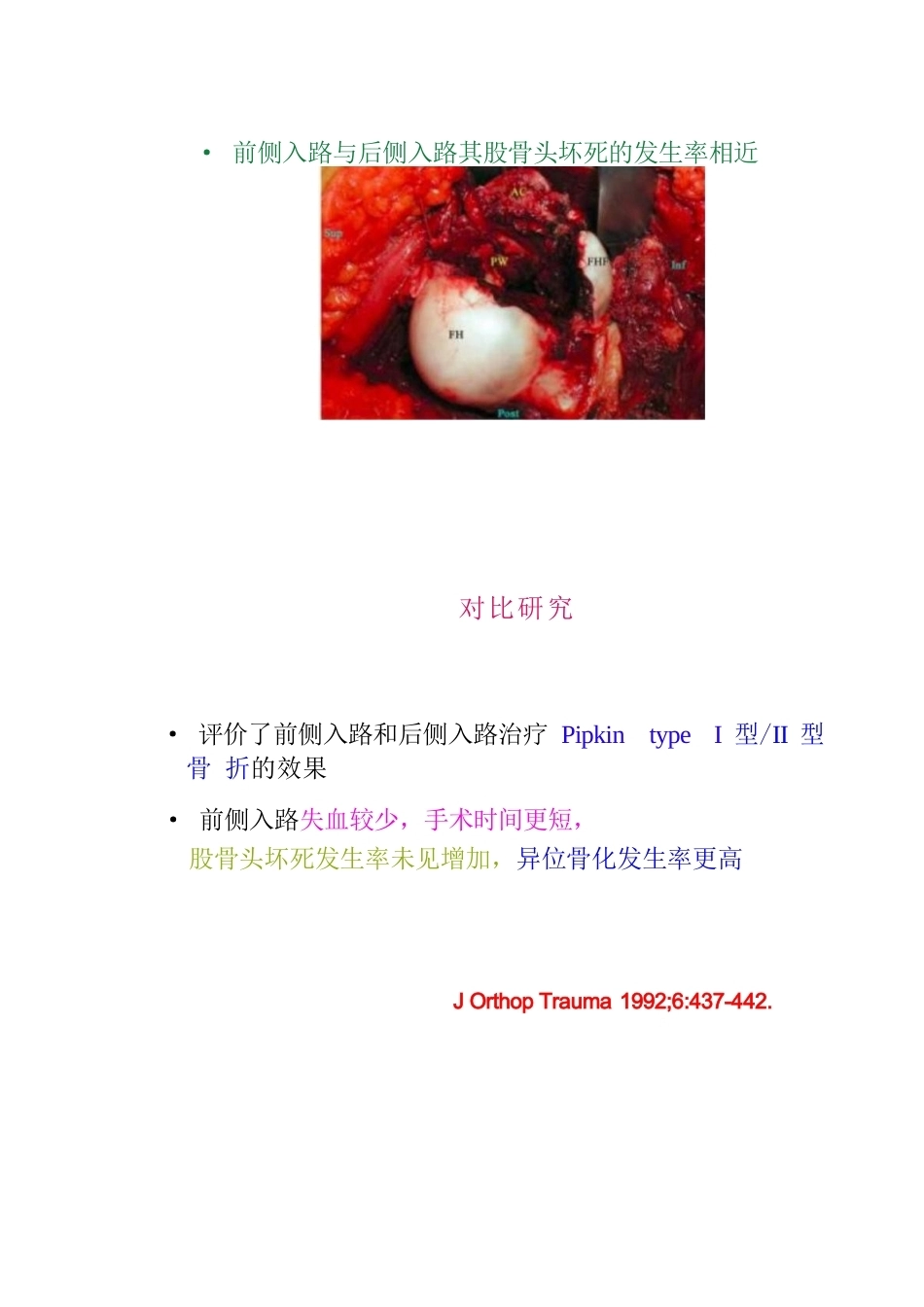 股骨头骨折的手 术入路及方法_第15页