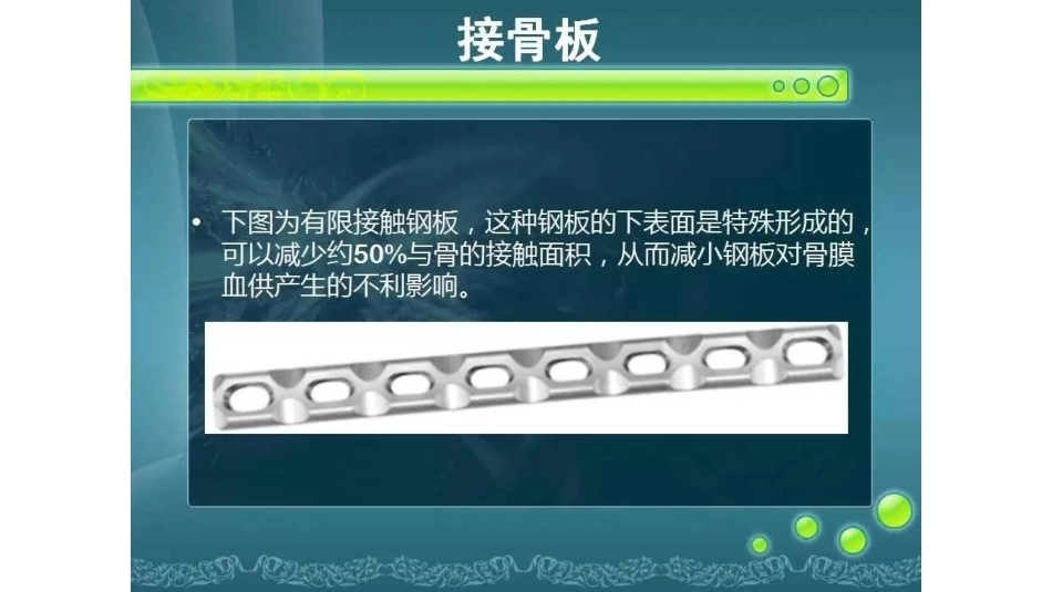 一篇掌握 骨折内固定_第12页