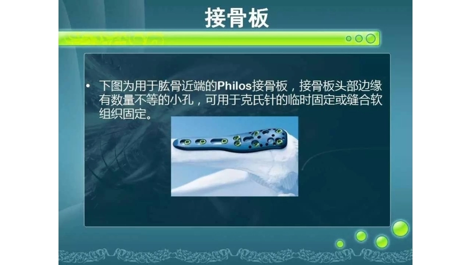 一篇掌握 骨折内固定_第13页