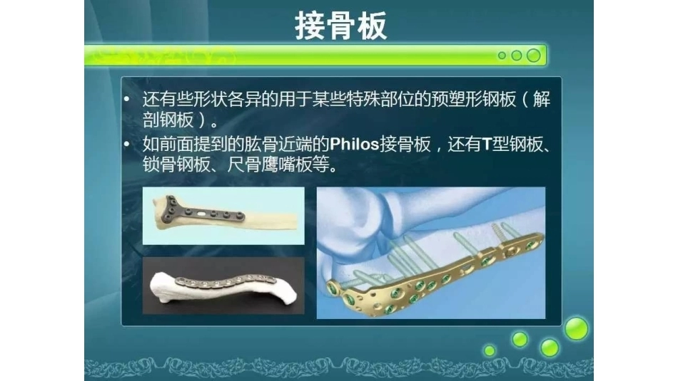 一篇掌握 骨折内固定_第14页