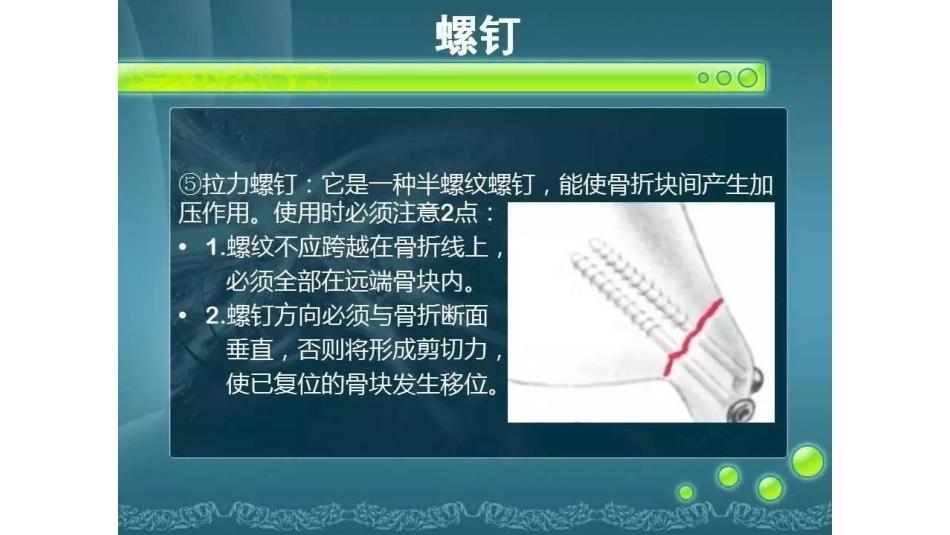 一篇掌握 骨折内固定_第7页