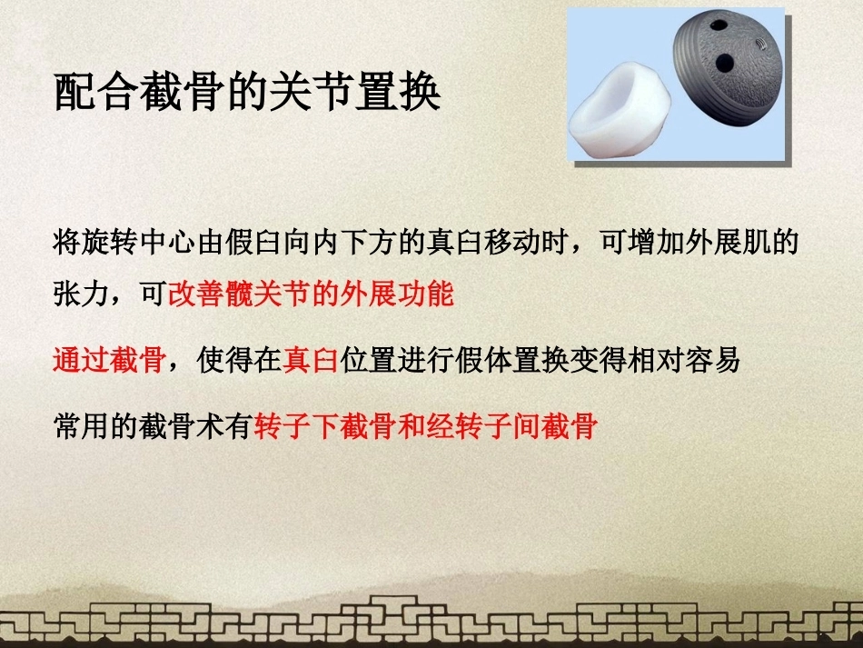 采取转子 间截骨治疗严重成人髋关节发育不良_第13页