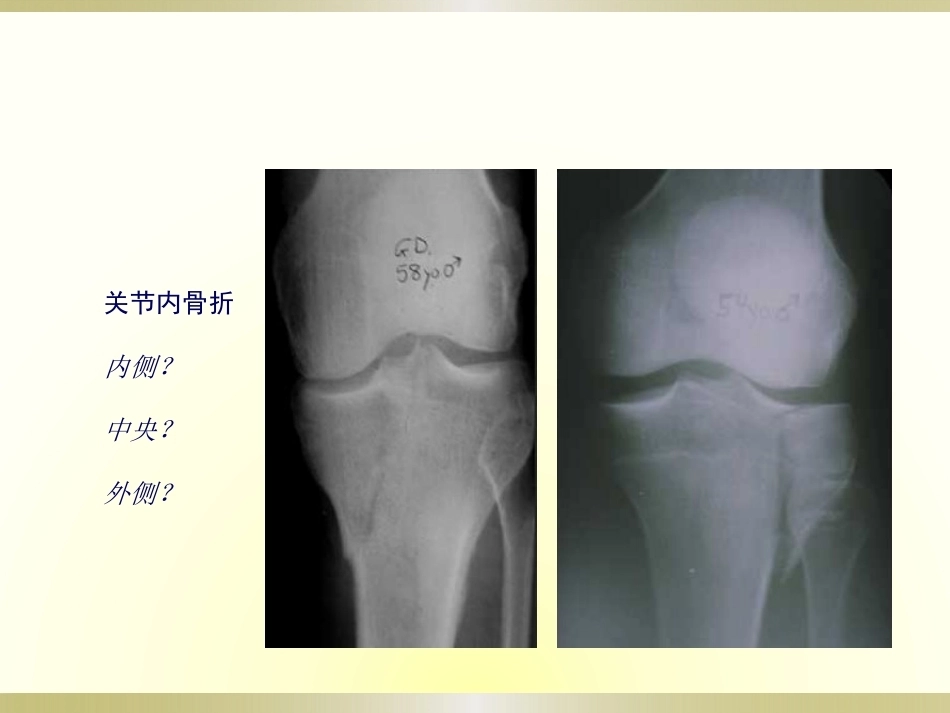 初学者必看.骨科读片_第10页