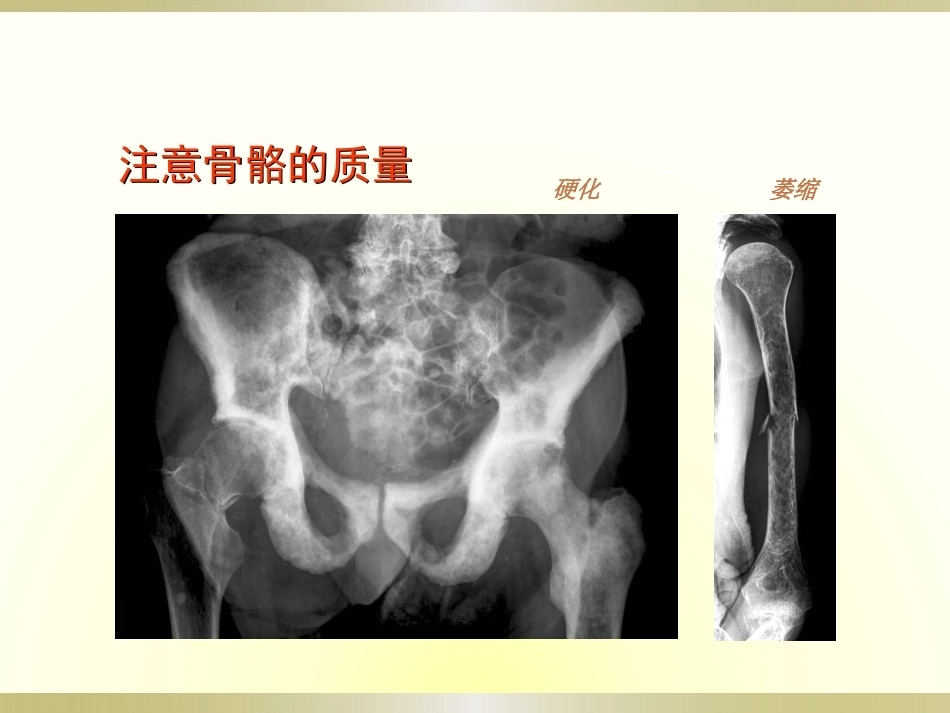 初学者必看.骨科读片_第14页
