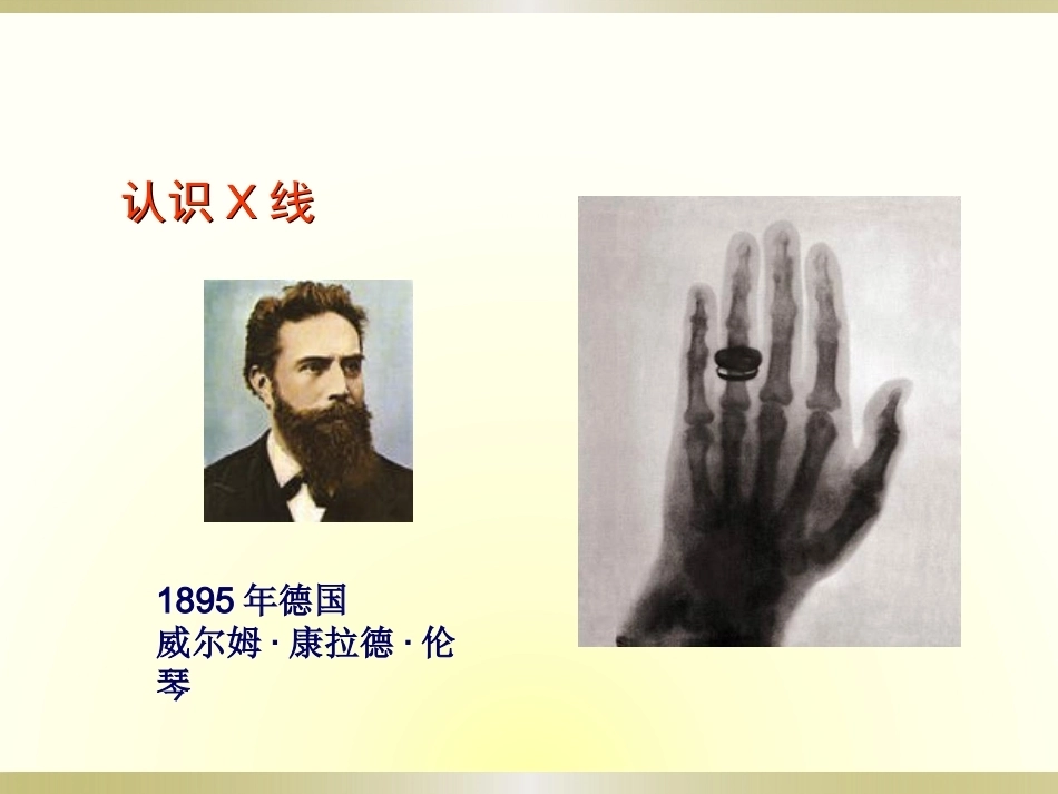 初学者必看.骨科读片_第2页