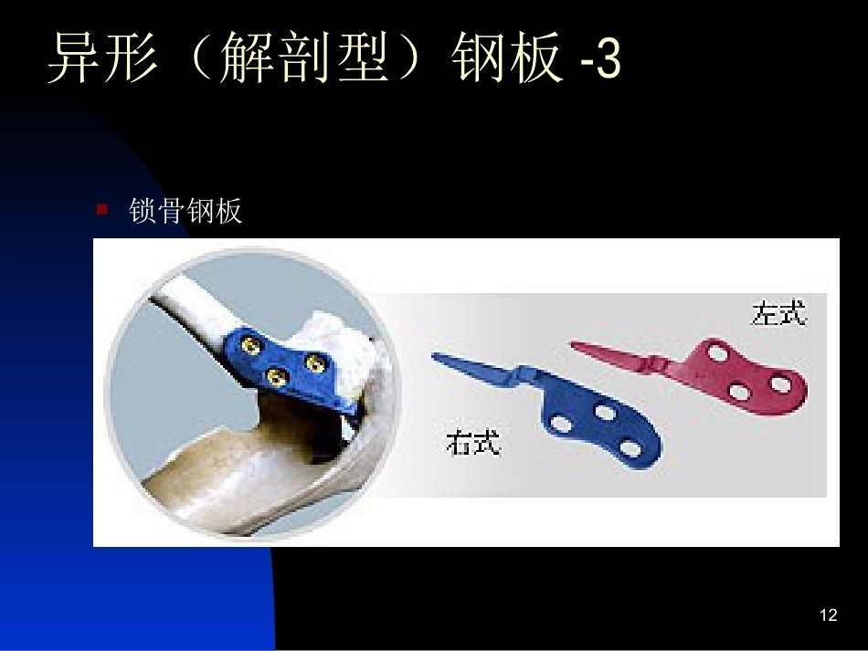 骨科常用内固定器械_第12页
