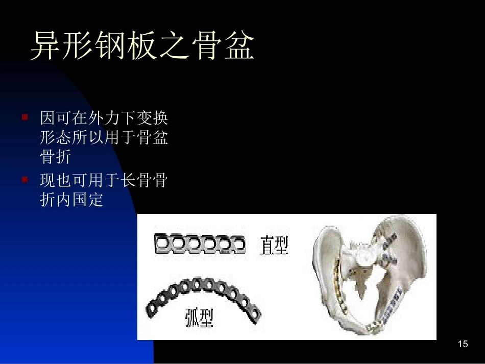 骨科常用内固定器械_第15页