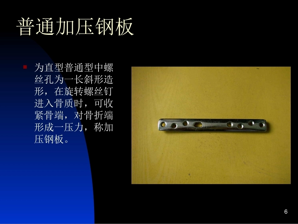 骨科常用内固定器械_第6页