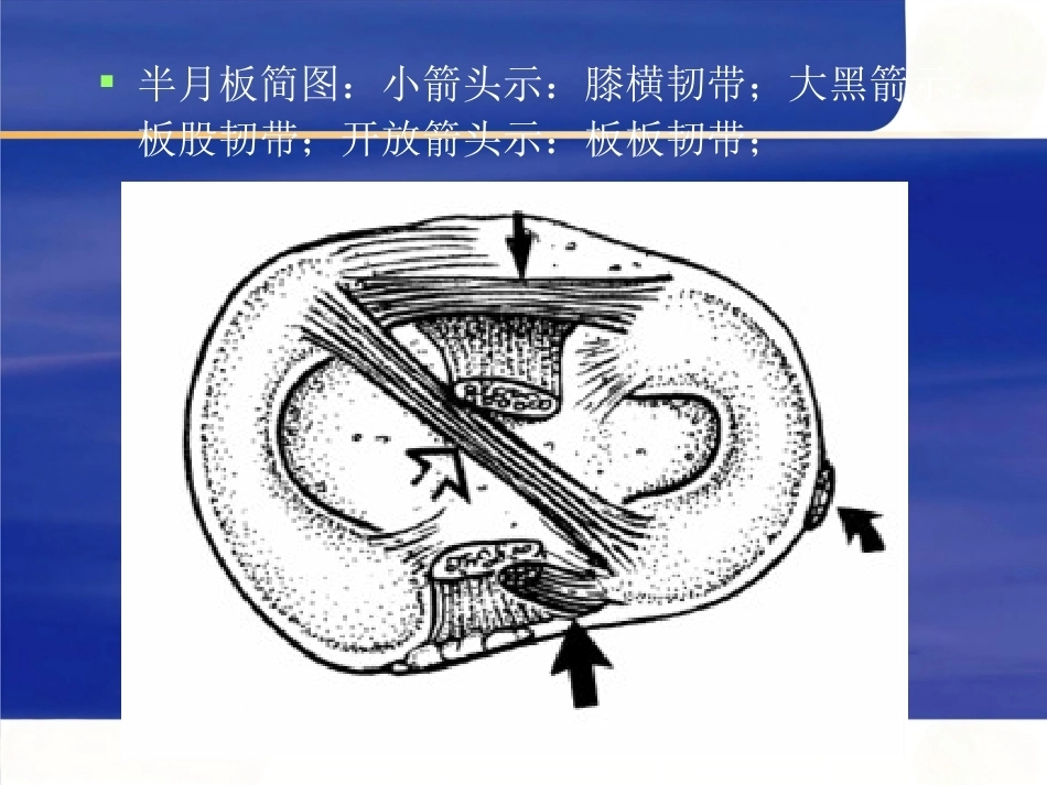 膝关节MRI 解剖及损伤_第3页