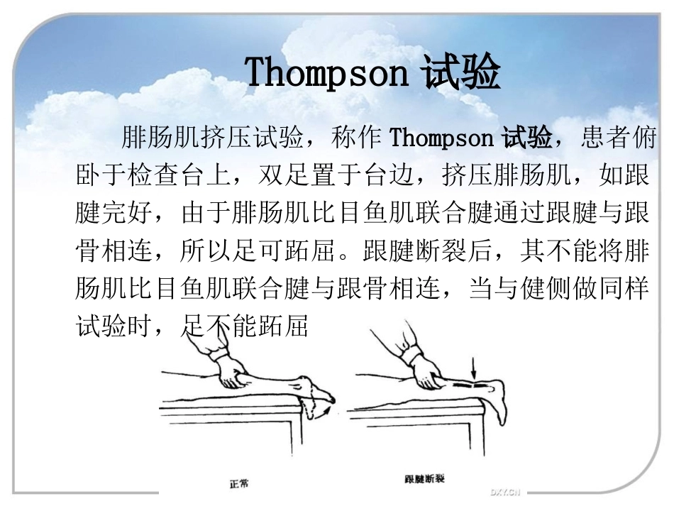 跟腱断裂的诊 断与治疗_第13页