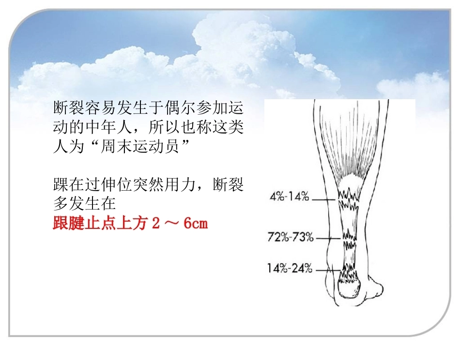 跟腱断裂的诊 断与治疗_第8页