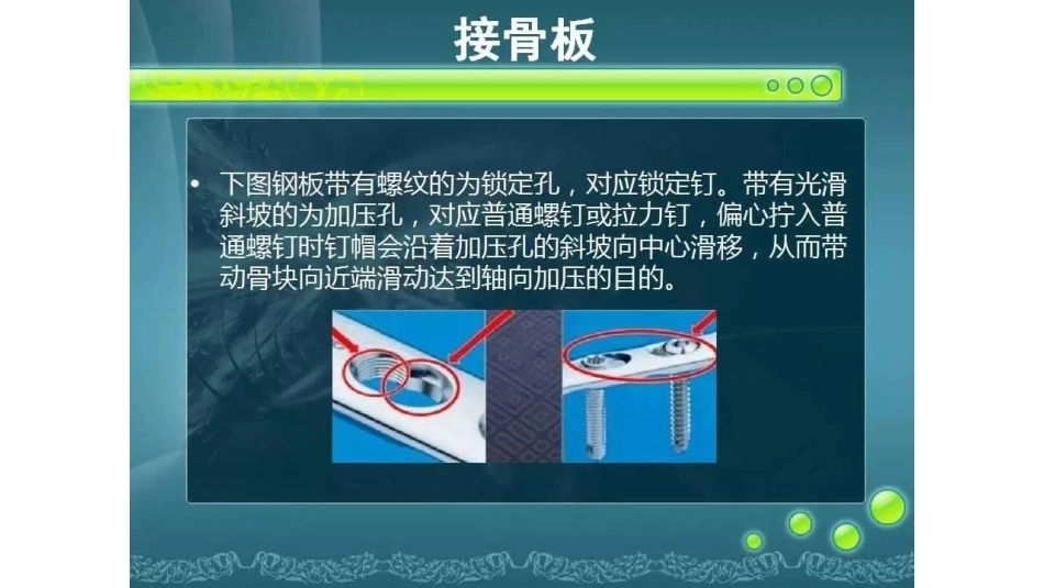 一篇掌握骨折 内固定_第11页
