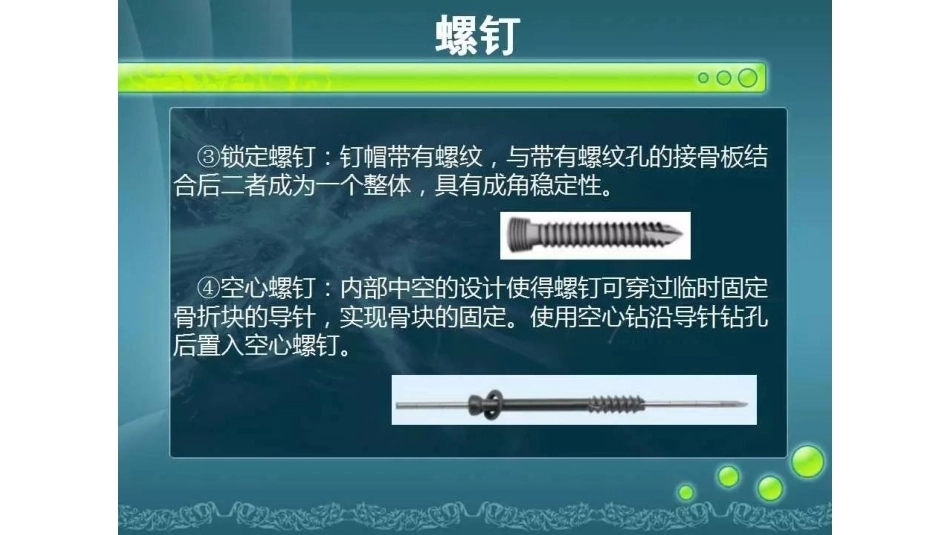 一篇掌握骨折 内固定_第6页