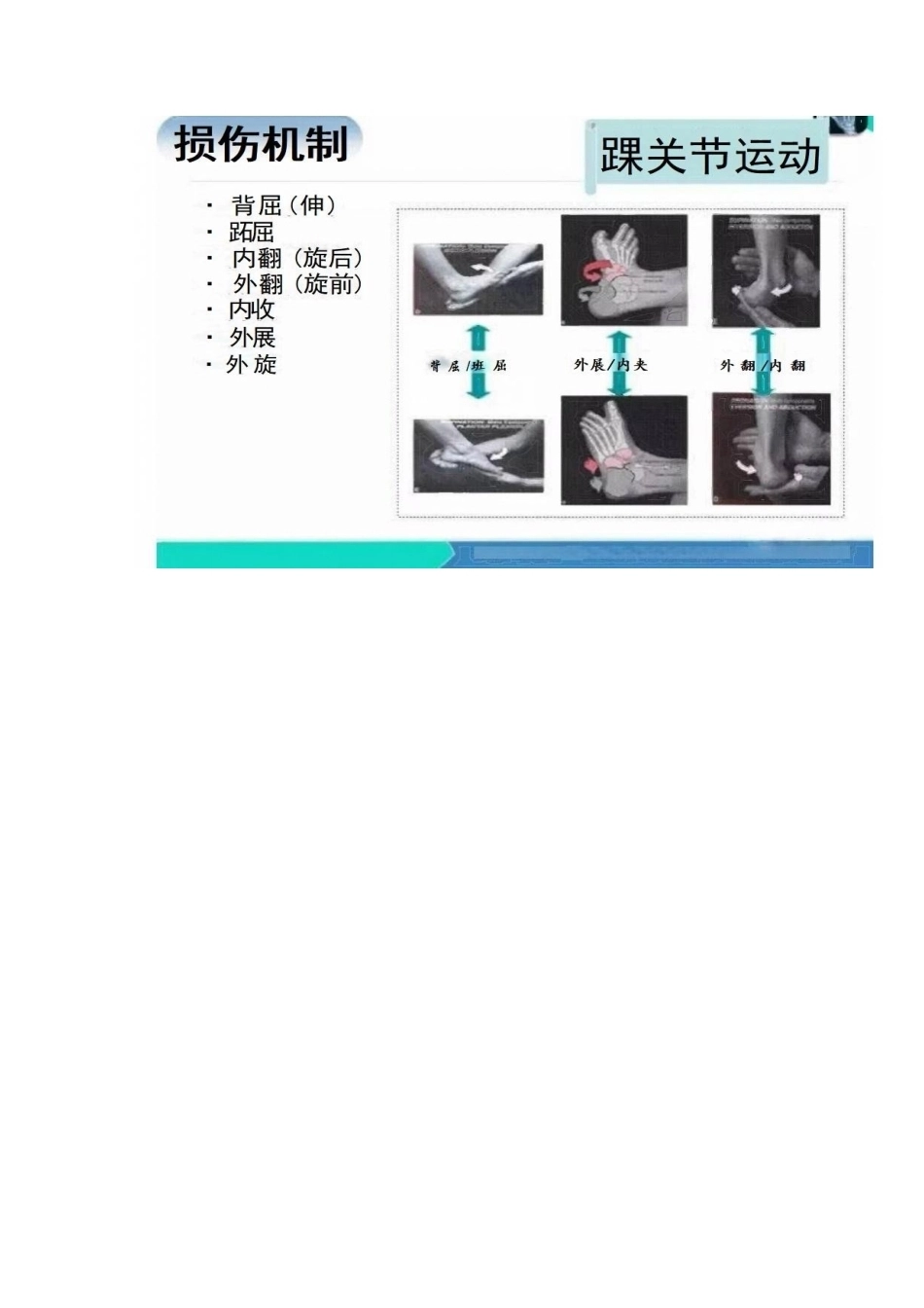 踝关节的急性损伤机制与分型_第13页