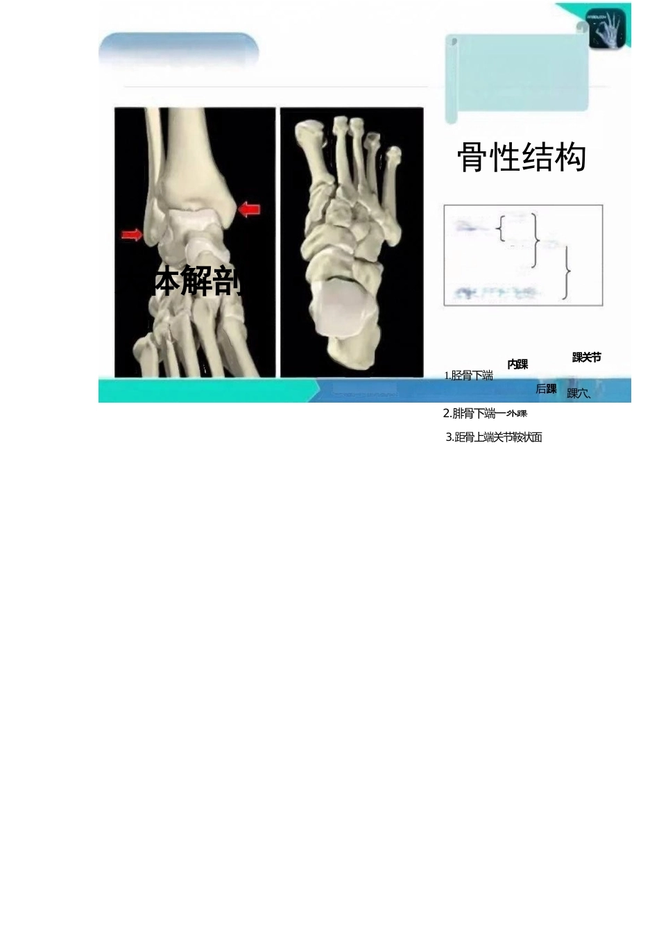 踝关节的急性损伤机制与分型_第4页