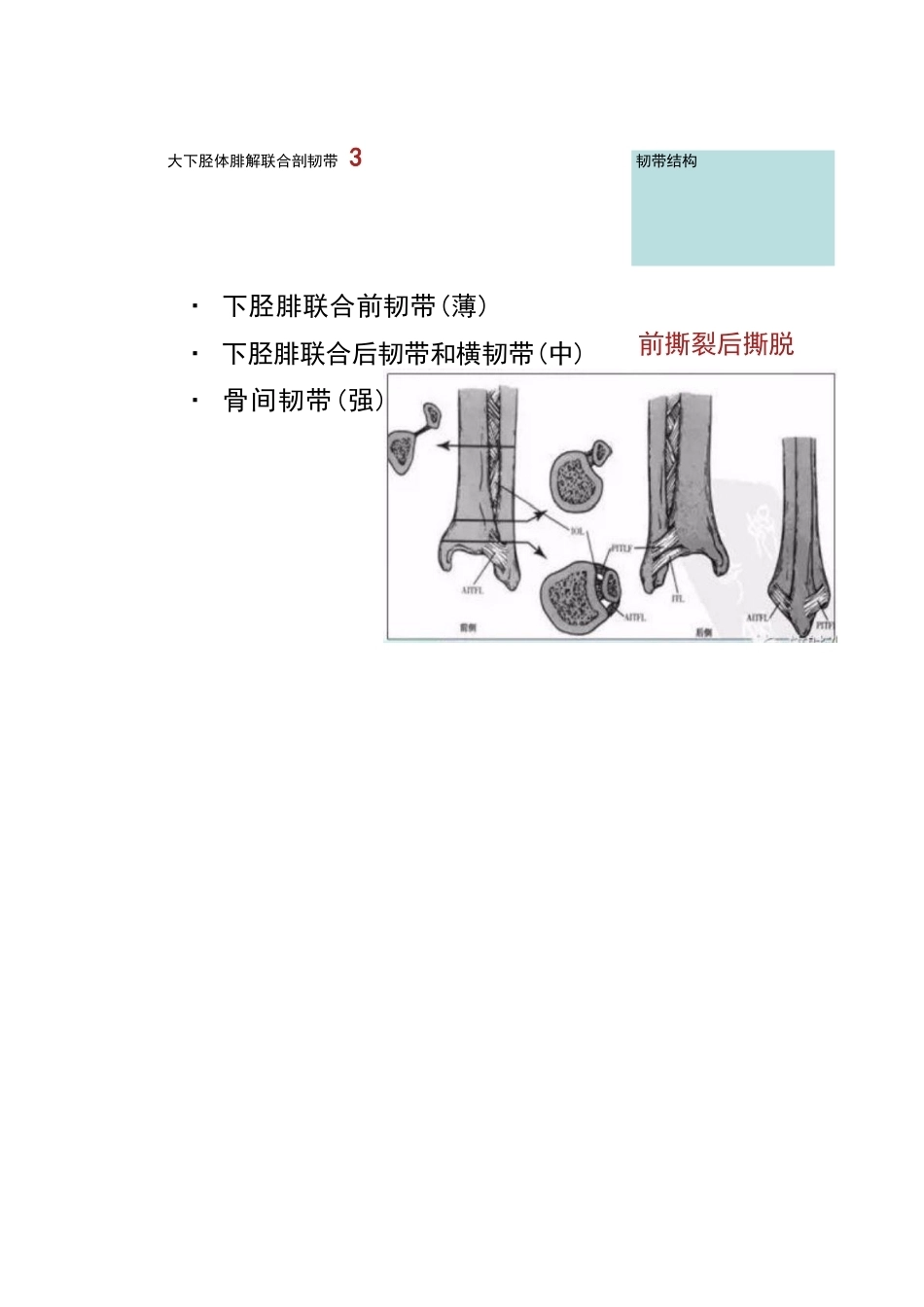踝关节的急性损伤机制与分型_第5页