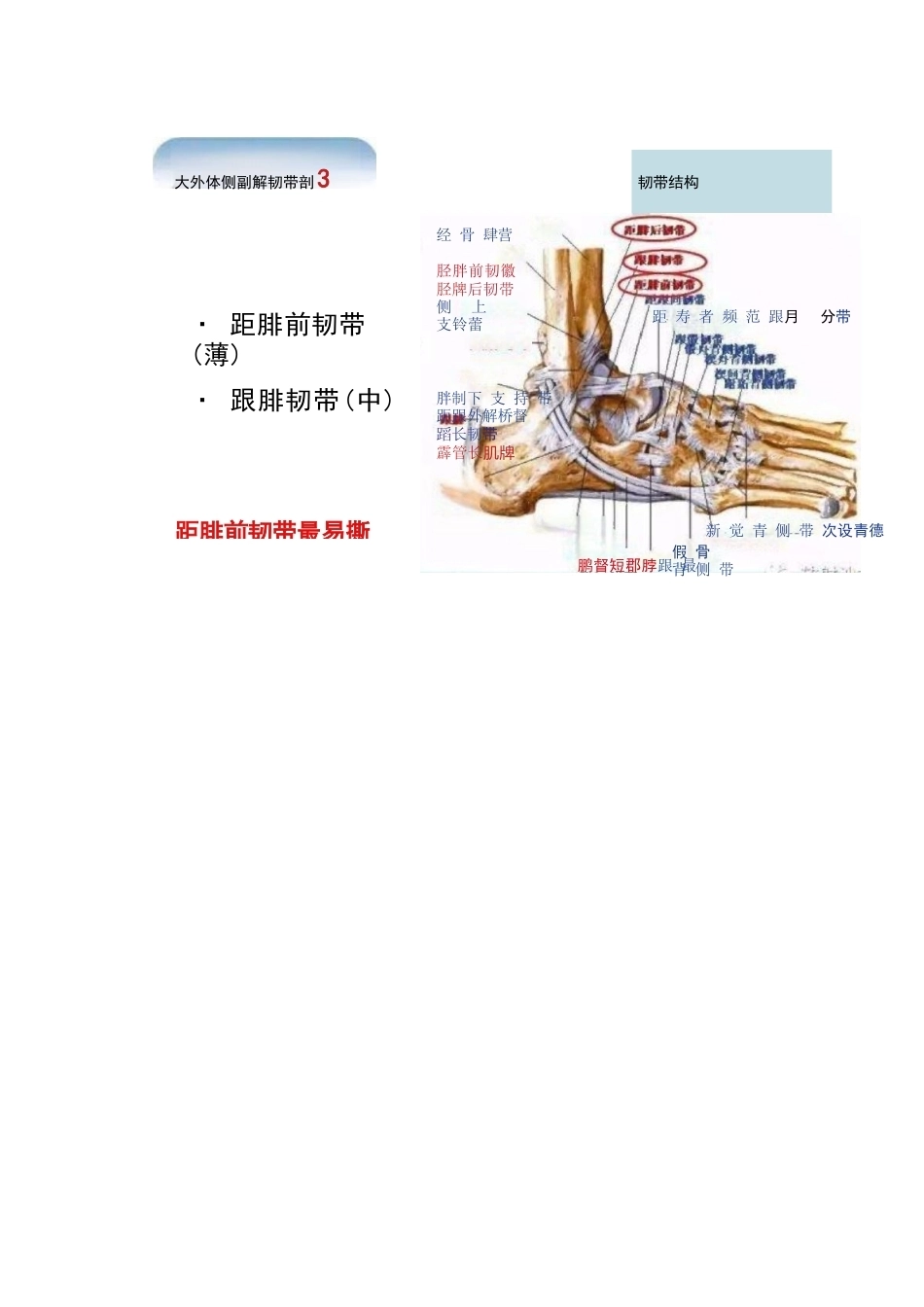 踝关节的急性损伤机制与分型_第6页