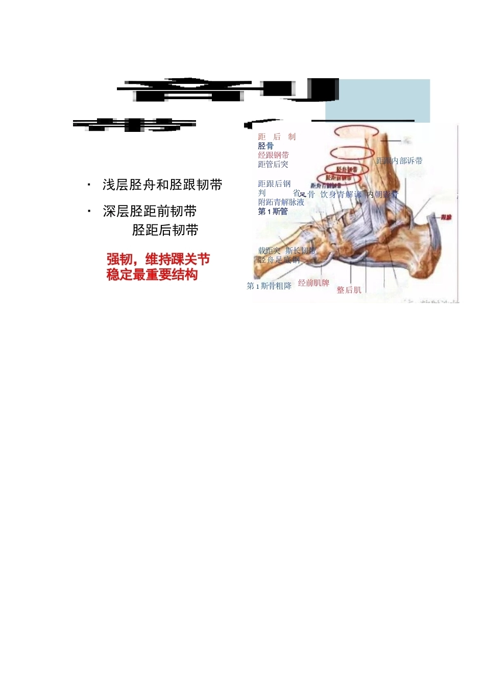 踝关节的急性损伤机制与分型_第7页