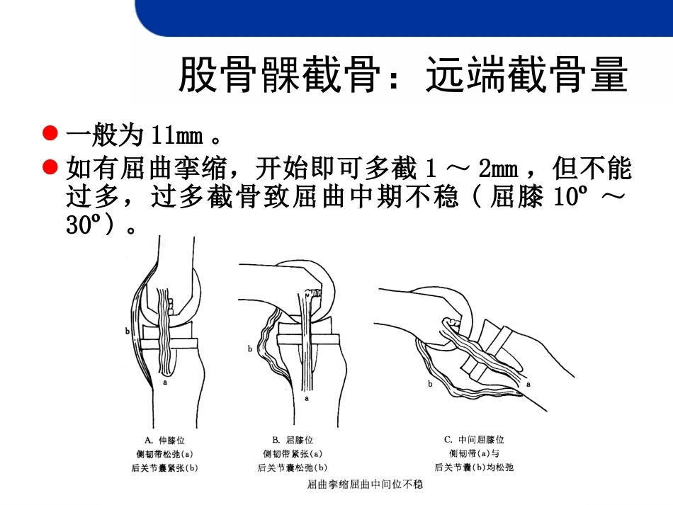 全膝 关节置换的截骨原则_第15页