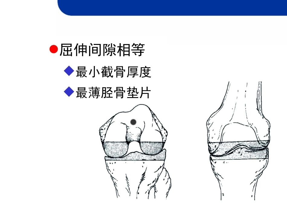 全膝 关节置换的截骨原则_第8页