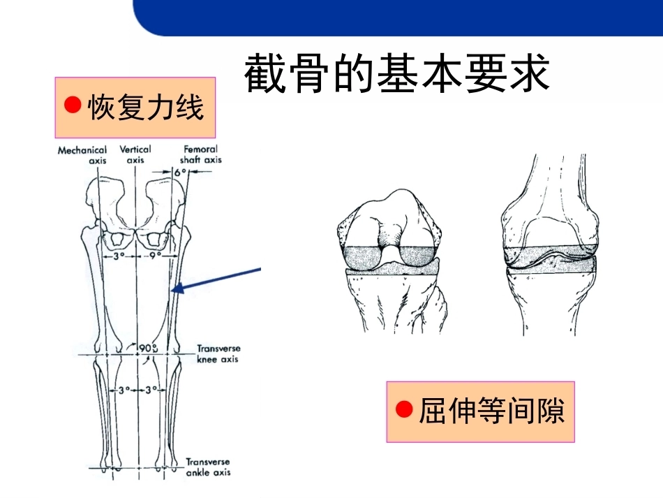 全膝关节置 换的截骨原则_第3页