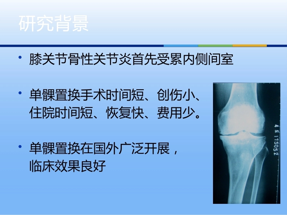 膝关节单髁 置换_第2页
