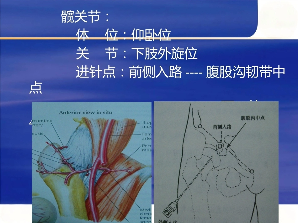 最新关节穿 刺术_第13页