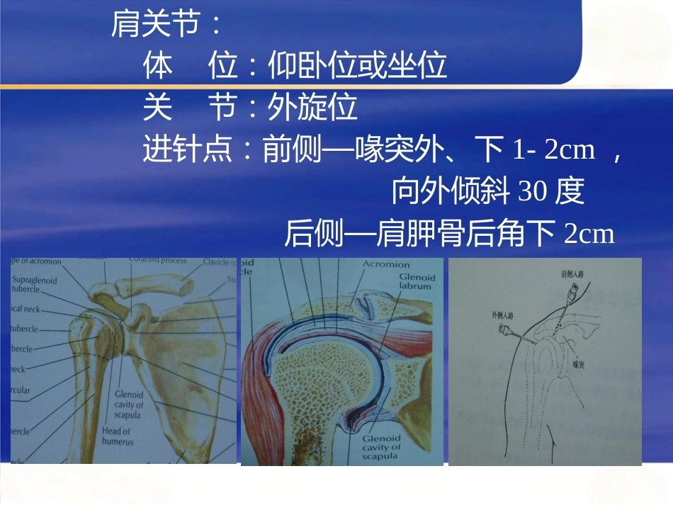 最新关节穿 刺术_第7页