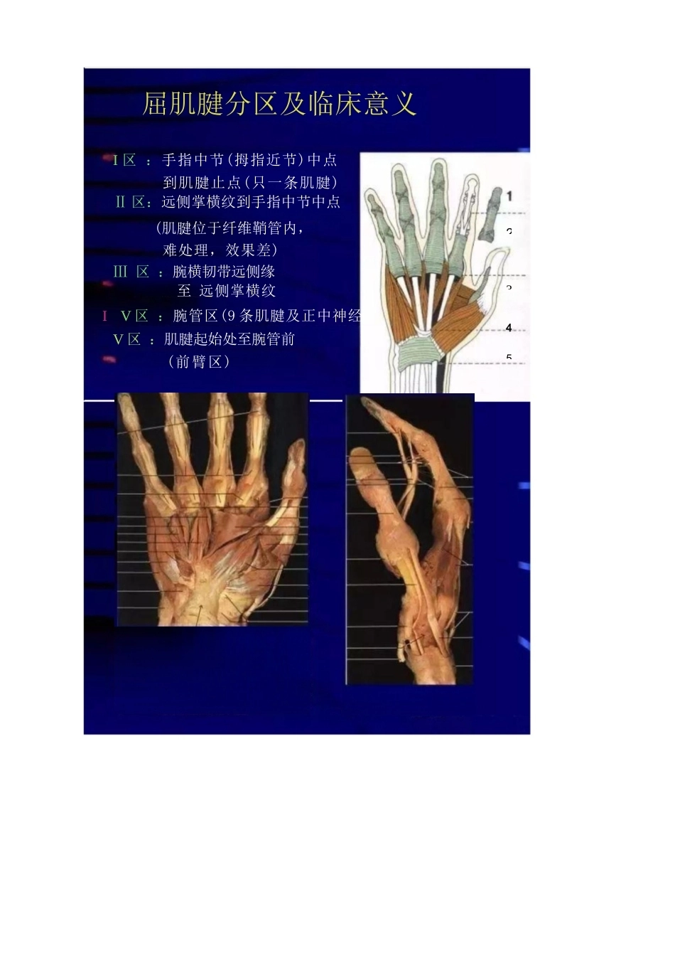 手外伤的常见处理 策略及要点_第10页