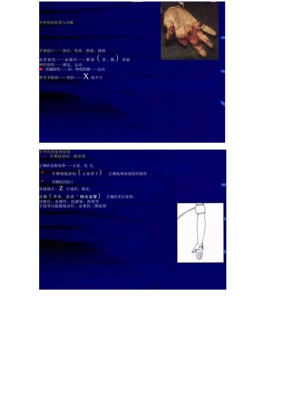 手外伤的常见处理 策略及要点_第3页