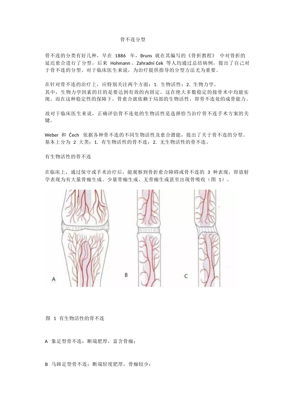 骨不连分型_第1页