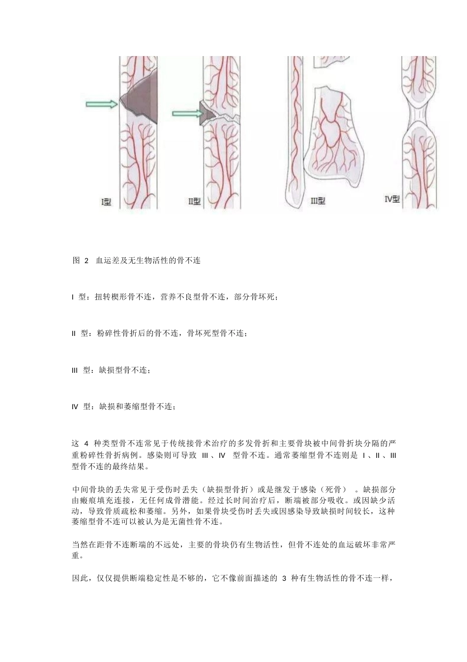 骨不连分型_第3页