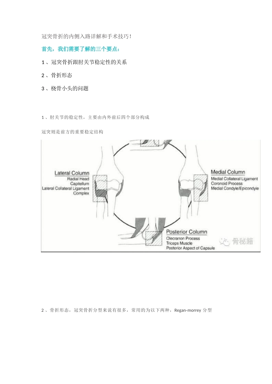 冠突骨折手 术技巧_第1页