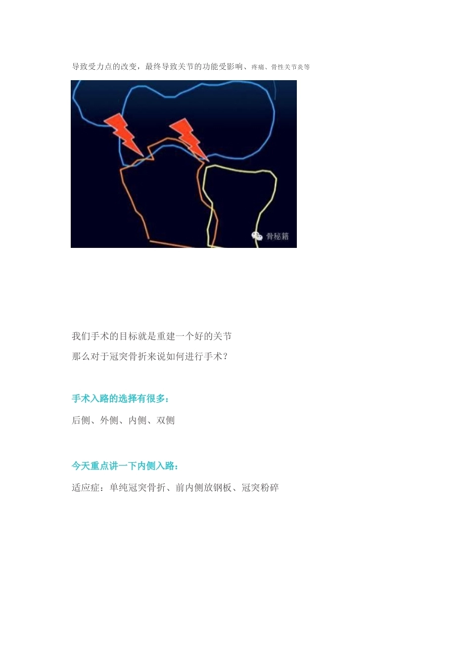 冠突骨折手 术技巧_第7页