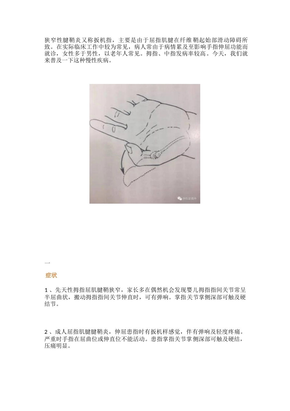 狭窄性腱鞘 炎治疗技巧_第1页